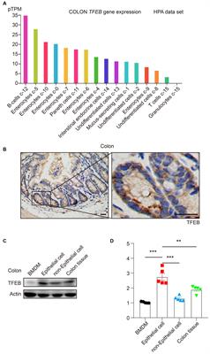 Colonic epithelial cell-specific TFEB activation: a key mechanism promoting anti-bacterial defense in response to Salmonella infection